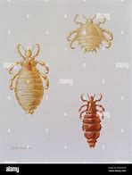 three skips of a louse
